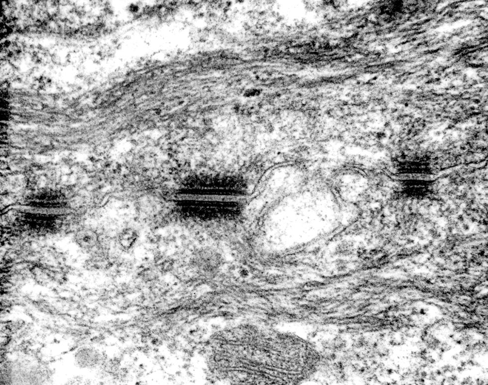 Desmosomes